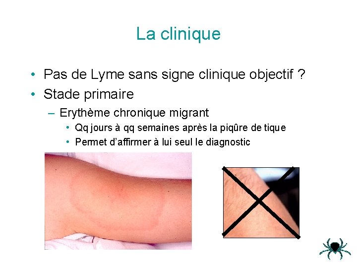 La clinique • Pas de Lyme sans signe clinique objectif ? • Stade primaire