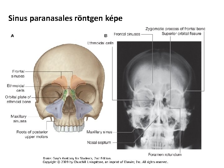 Sinus paranasales röntgen képe 