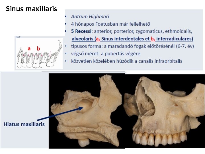 Sinus maxillaris 
