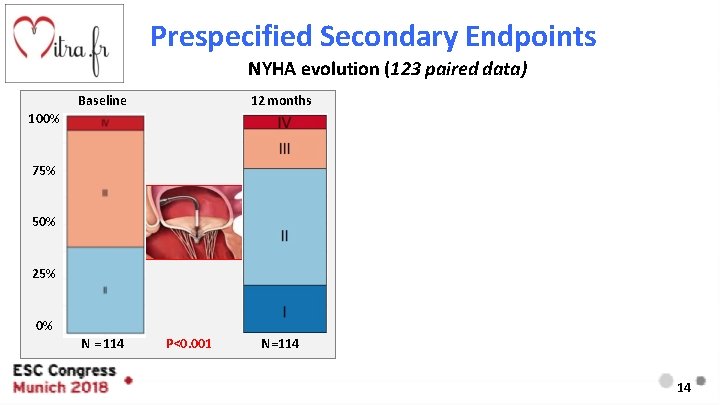 Prespecified Secondary Endpoints NYHA evolution (123 paired data) Baseline 12 months 100% 75% 50%