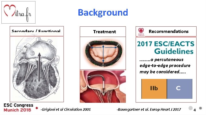 Background Secondary / Functional Treatment Recommendations . . . . a percutaneous edge-to-edge procedure