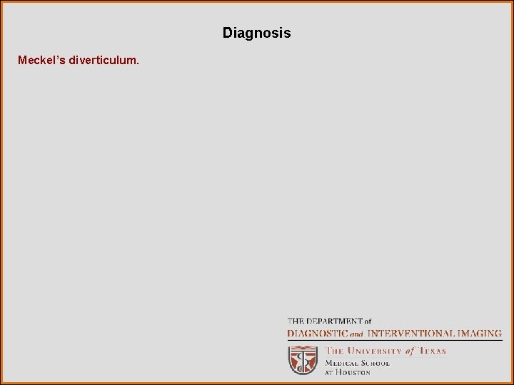 Diagnosis Meckel’s diverticulum. 