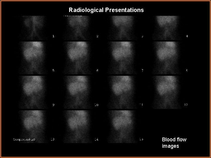 Radiological Presentations Blood flow images Radiological Presentations Blood flow images