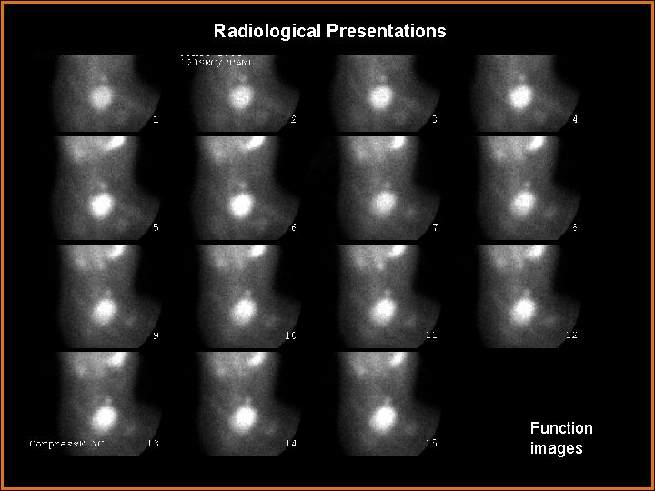 Radiological Presentations Function images 