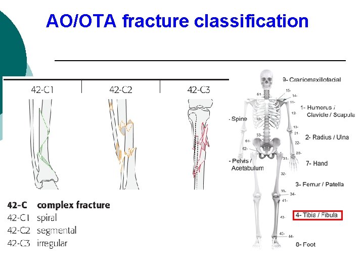 AO/OTA fracture classification 