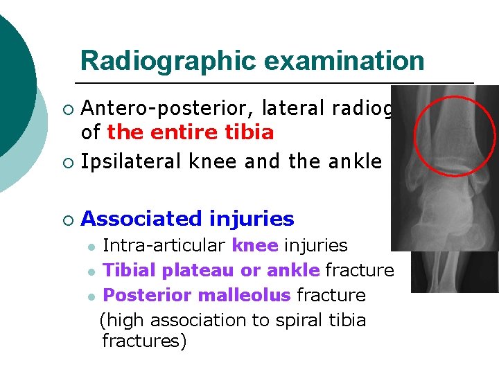 Radiographic examination Antero-posterior, lateral radiographs of the entire tibia ¡ Ipsilateral knee and the