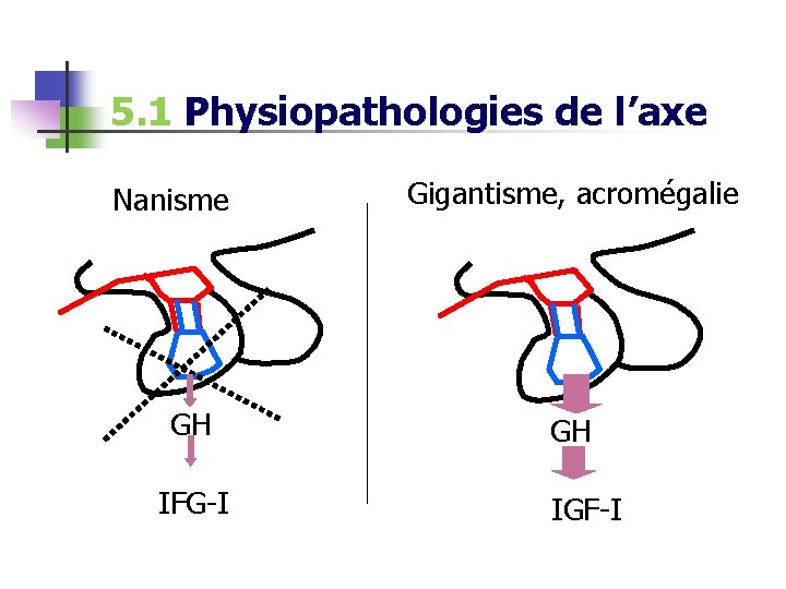 5. 1 Physiopathologies de l’axe Nanisme GH IFG-I Gigantisme, acromégalie GH IGF-I 