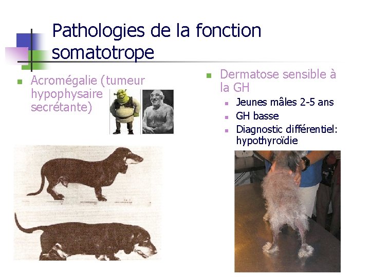 Pathologies de la fonction somatotrope n Acromégalie (tumeur hypophysaire secrétante) n Dermatose sensible à