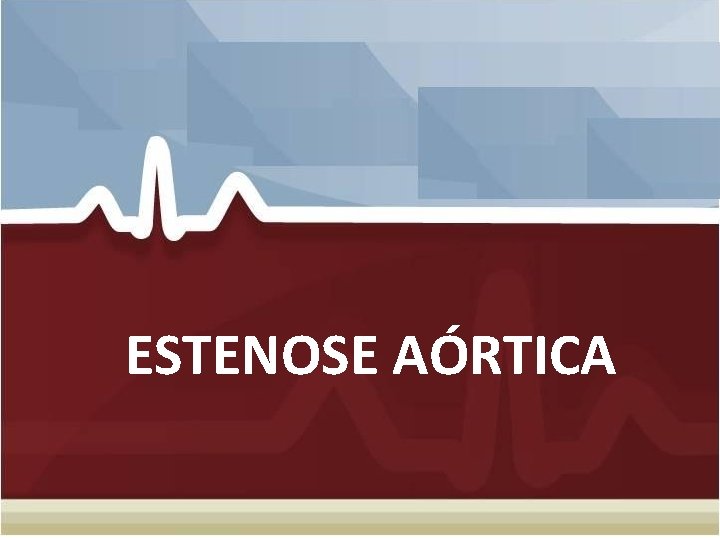 ESTENOSE AÓRTICA ESTENOSE AÓRTICA
