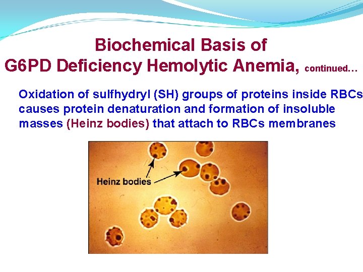 Biochemical Basis of G 6 PD Deficiency Hemolytic Anemia, continued… Oxidation of sulfhydryl (SH)