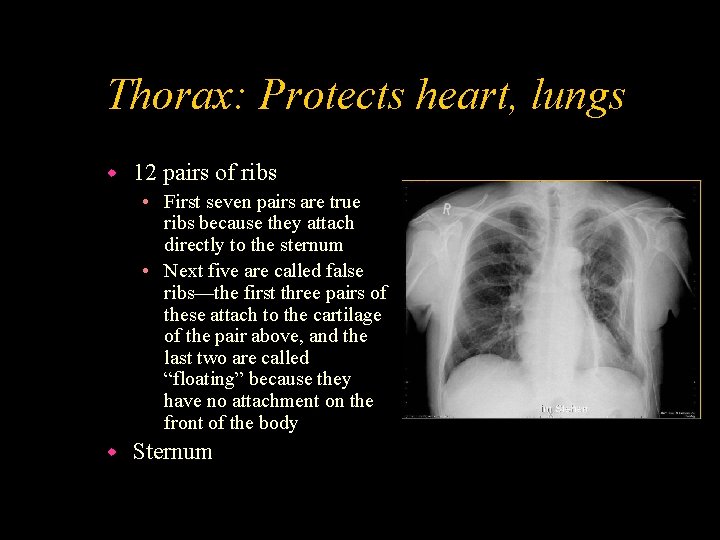 Thorax: Protects heart, lungs w 12 pairs of ribs • First seven pairs are