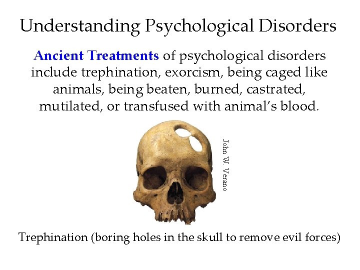 Understanding Psychological Disorders Ancient Treatments of psychological disorders include trephination, exorcism, being caged like