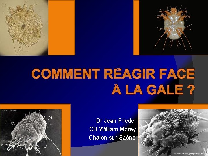 COMMENT RÉAGIR FACE À LA GALE ? Dr Jean Friedel CH William Morey Chalon-sur-Saône