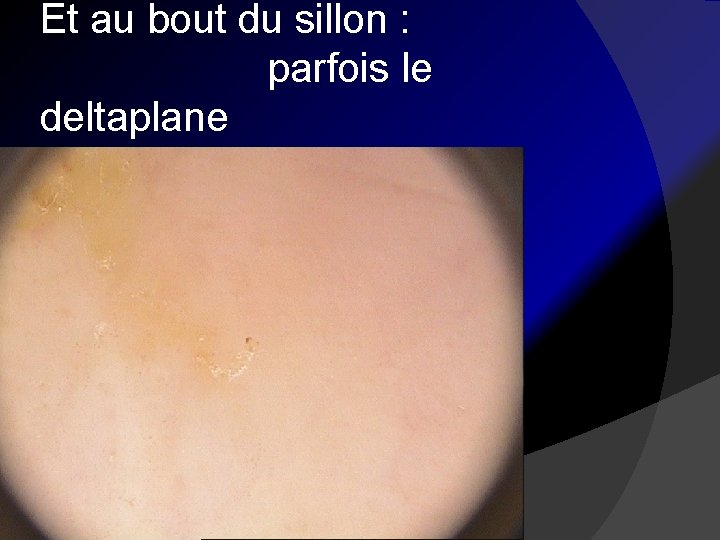 Et au bout du sillon : parfois le deltaplane 