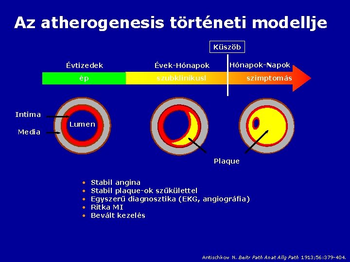 Az atherogenesis történeti modellje Küszöb Évtizedek Évek-Hónapok ép szubklinikusl Hónapok-Napok szimptomás Intima Media Lumen