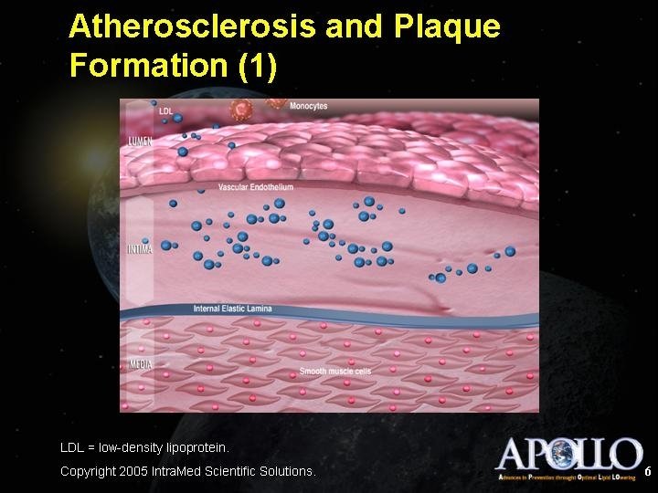 Atherosclerosis and Plaque Formation (1) 