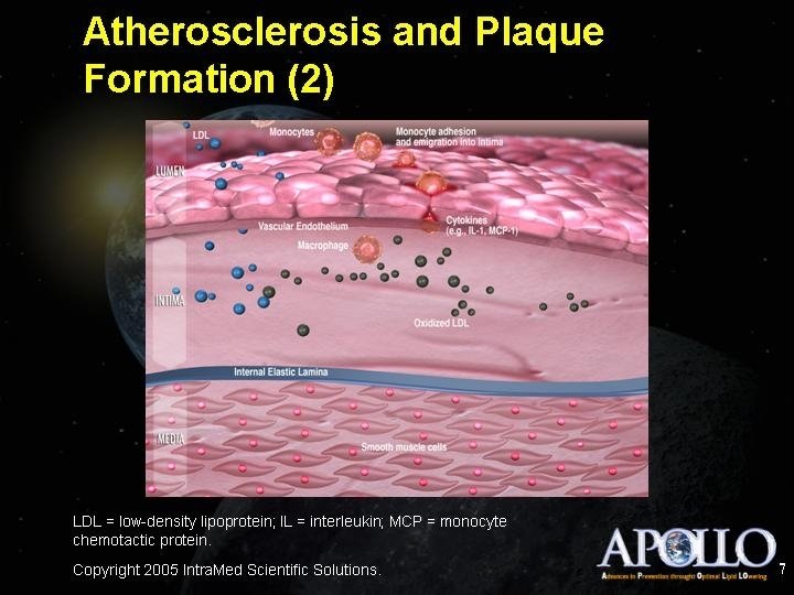 Atherosclerosis and Plaque Formation (2) 