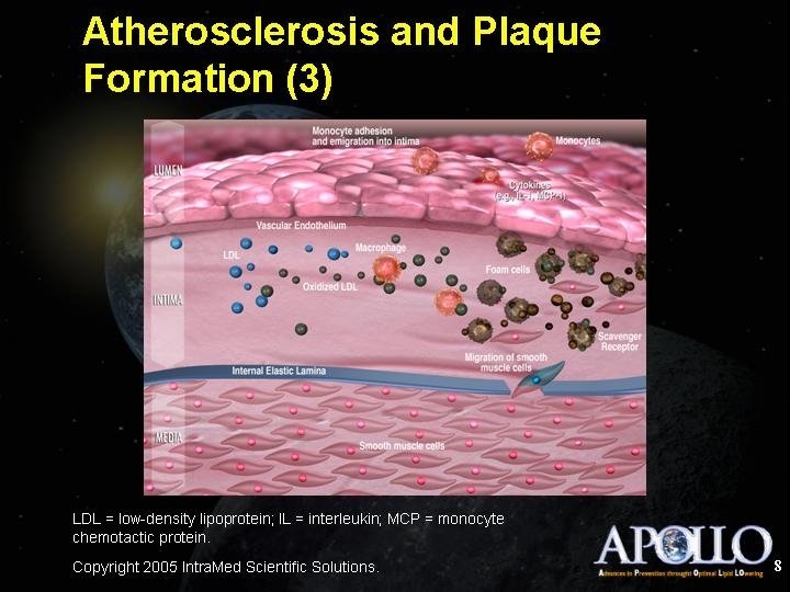 Atherosclerosis and Plaque Formation (3) 