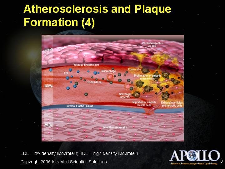 Atherosclerosis and Plaque Formation (4) 