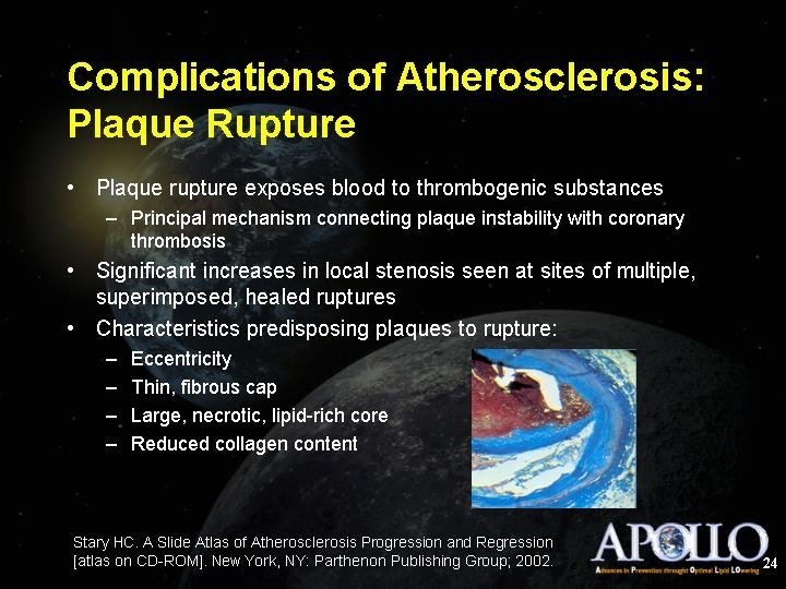 Complications of Atherosclerosis: Plaque Rupture 