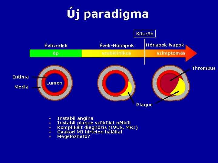 Új paradigma Küszöb Évtizedek Évek-Hónapok ép szubklinikus Hónapok-Napok szimptomás Thrombus Intima Media Lumen Plaque