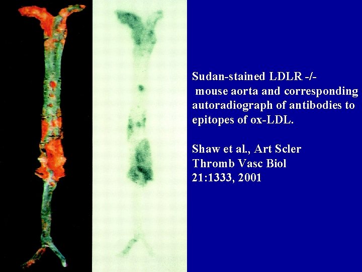 Sudan-stained LDLR -/mouse aorta and corresponding autoradiograph of antibodies to epitopes of ox-LDL. Shaw