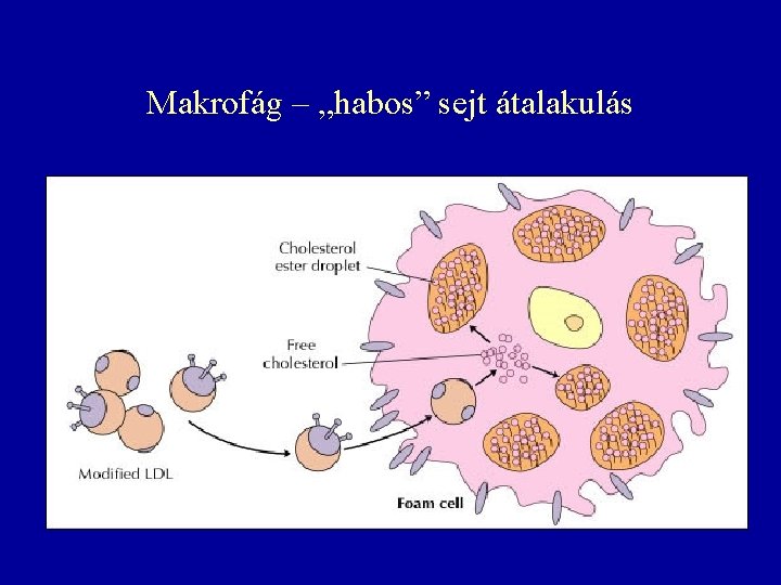 Makrofág – „habos” sejt átalakulás 