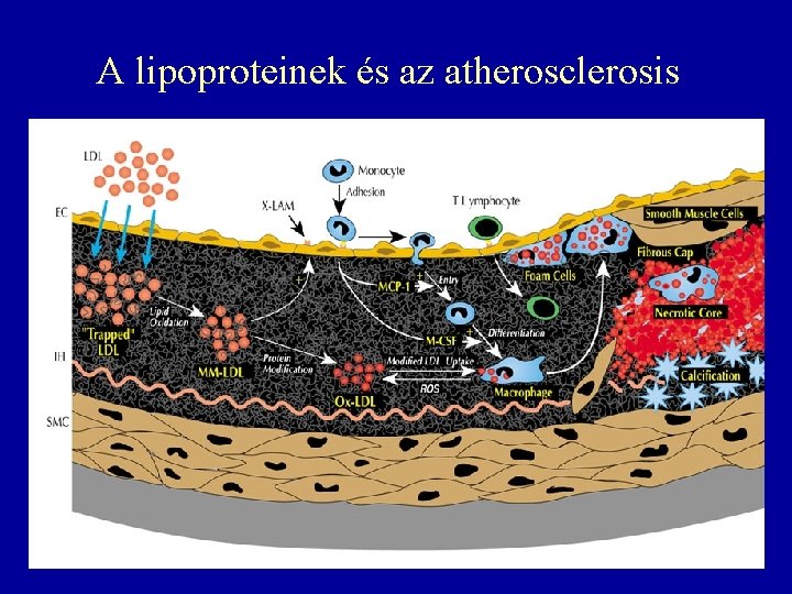 A lipoproteinek és az atherosclerosis 