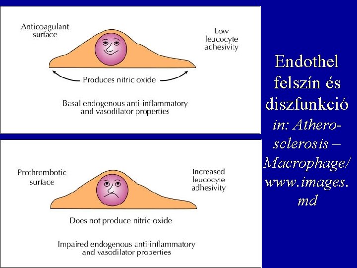 Endothel felszín és diszfunkció in: Atherosclerosis – Macrophage/ www. images. md 