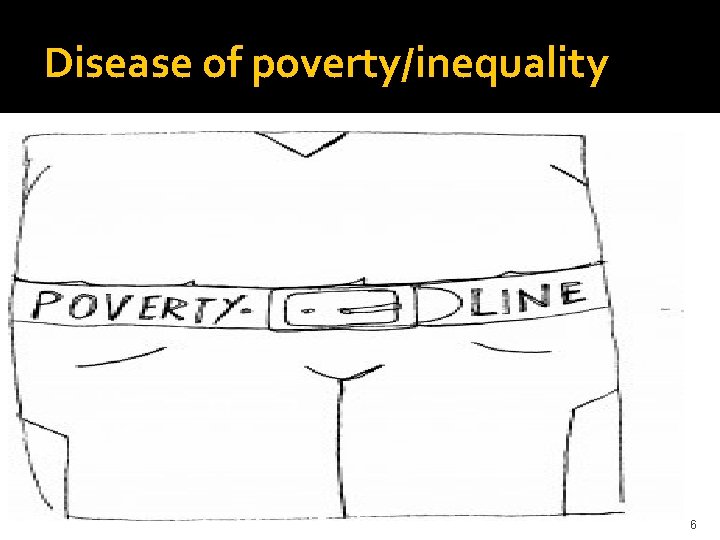 Disease of poverty/inequality 6 