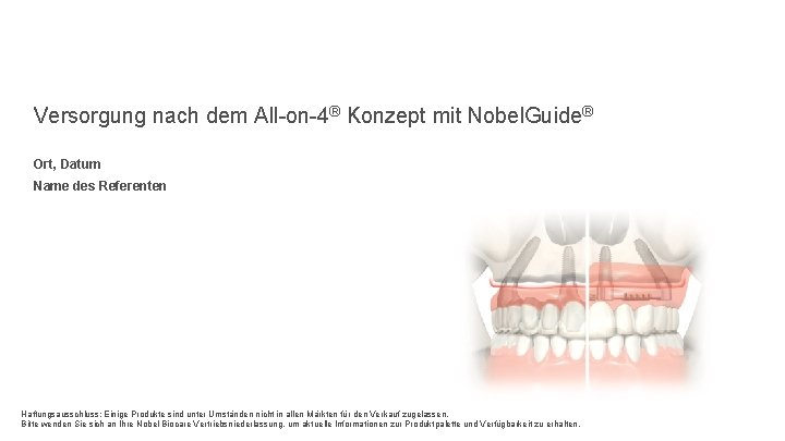 Versorgung nach dem All-on-4® Konzept mit Nobel. Guide® Ort, Datum Name des Referenten Haftungsausschluss: