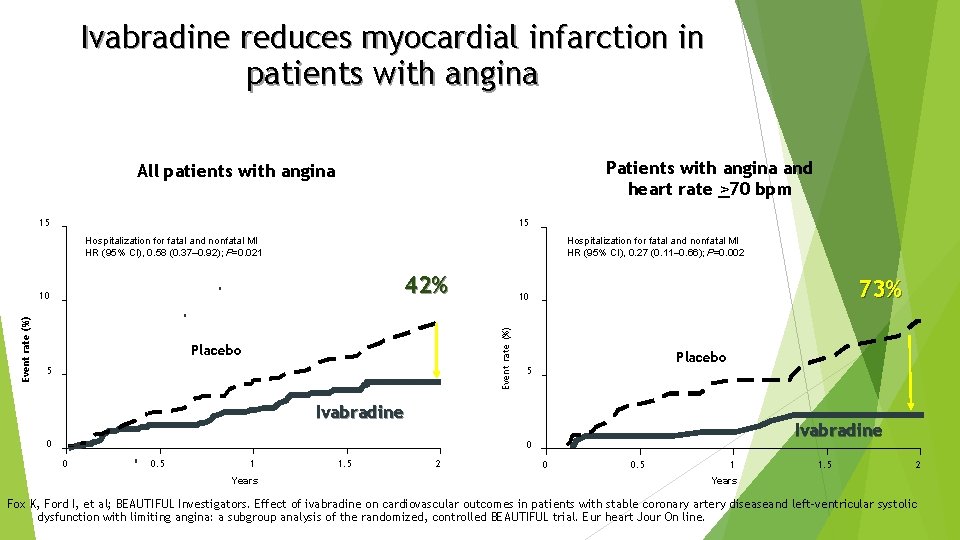 Ivabradine reduces myocardial infarction in patients with angina Patients with angina and heart rate