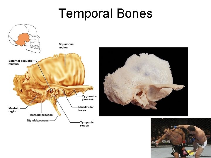 Temporal Bones Figure 7. 5 