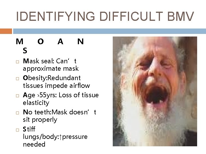 IDENTIFYING DIFFICULT BMV M S O A N Mask seal: Can’t approximate mask Obesity: