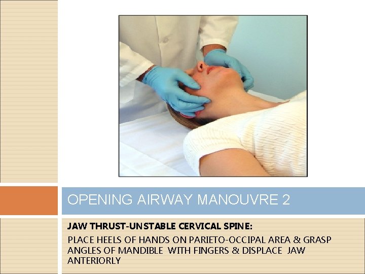 OPENING AIRWAY MANOUVRE 2 JAW THRUST-UNSTABLE CERVICAL SPINE: PLACE HEELS OF HANDS ON PARIETO-OCCIPAL