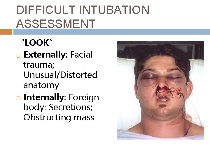 DIFFICULT INTUBATION ASSESSMENT “LOOK” Externally: Facial trauma; Unusual/Distorted anatomy Internally: Foreign body; Secretions; Obstructing