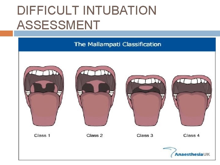 DIFFICULT INTUBATION ASSESSMENT 