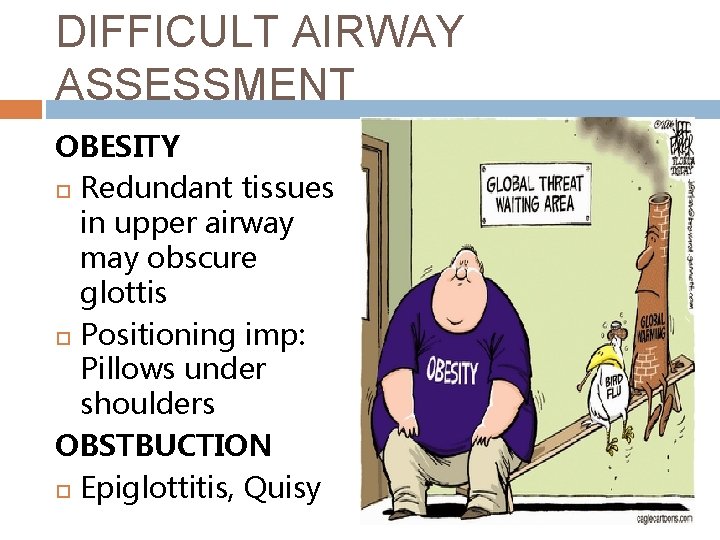 DIFFICULT AIRWAY ASSESSMENT OBESITY Redundant tissues in upper airway may obscure glottis Positioning imp: