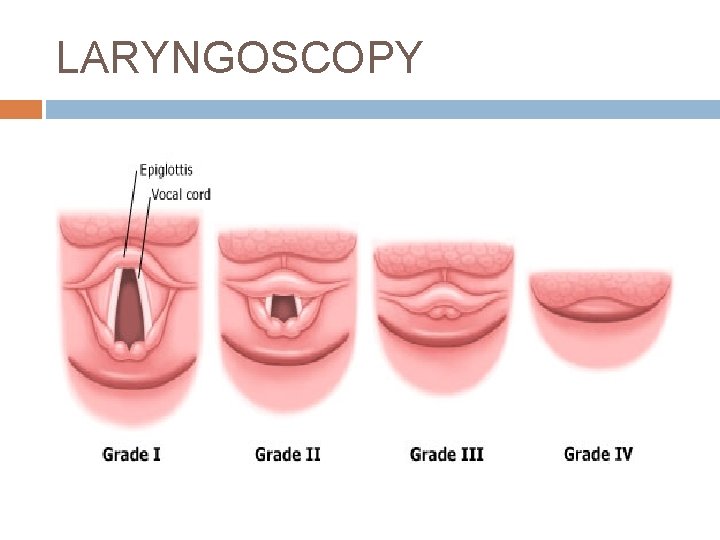 LARYNGOSCOPY 