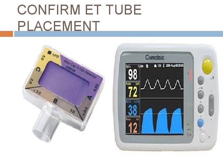 CONFIRM ET TUBE PLACEMENT 