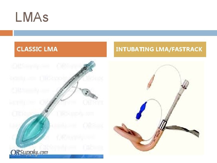 LMAs CLASSIC LMA INTUBATING LMA/FASTRACK 