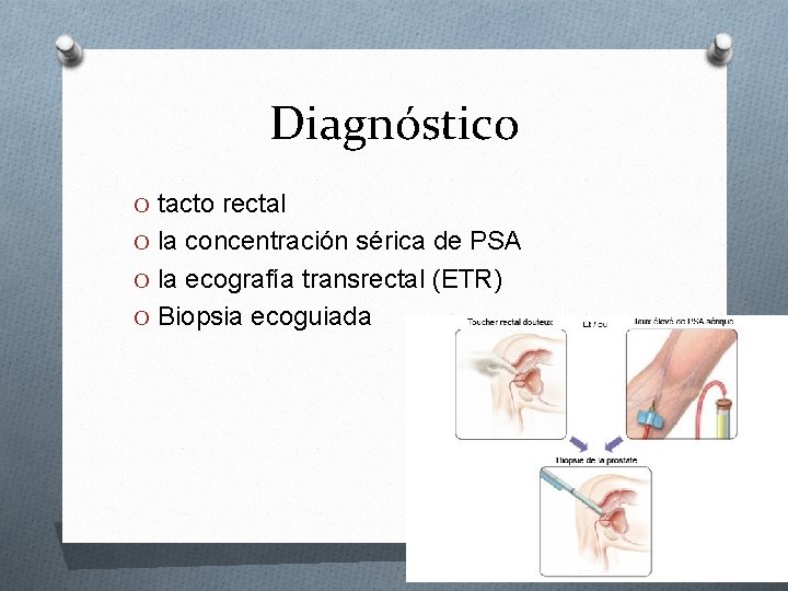 Diagnóstico O tacto rectal O la concentración sérica de PSA O la ecografía transrectal