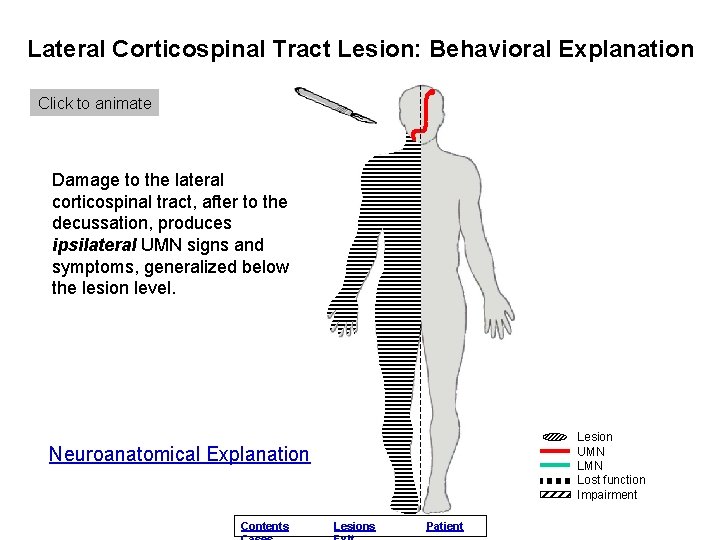 Lateral Corticospinal Tract Lesion: Behavioral Explanation Click to animate Damage to the lateral corticospinal