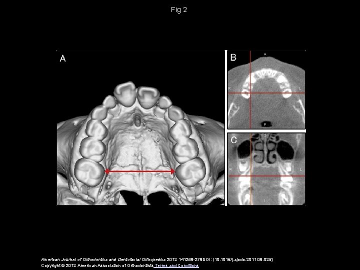 Fig 2 American Journal of Orthodontics and Dentofacial Orthopedics 2012 141269 -278 DOI: (10.