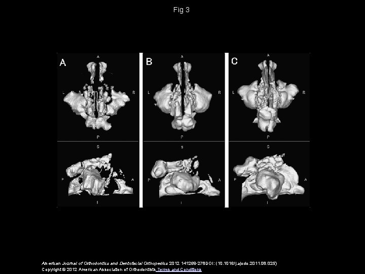 Fig 3 American Journal of Orthodontics and Dentofacial Orthopedics 2012 141269 -278 DOI: (10.