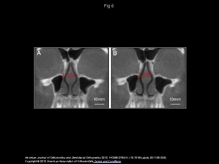 Fig 6 American Journal of Orthodontics and Dentofacial Orthopedics 2012 141269 -278 DOI: (10.