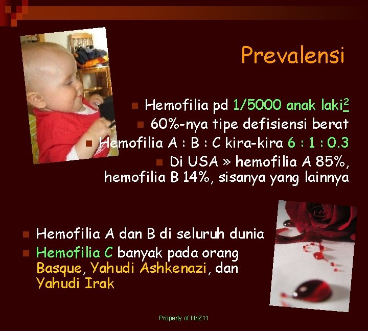 Prevalensi Hemofilia pd 1/5000 anak laki 2 n 60%-nya tipe defisiensi berat Hemofilia A