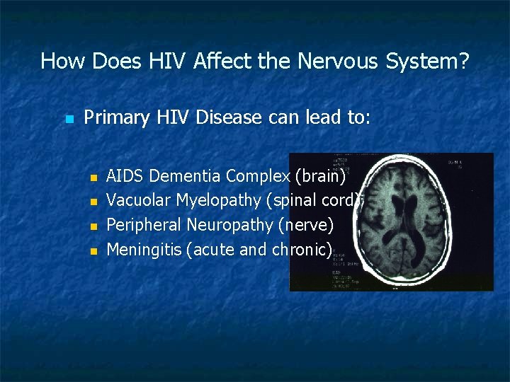 How Does HIV Affect the Nervous System? n Primary HIV Disease can lead to: How Does HIV Affect the Nervous System? n Primary HIV Disease can lead to: