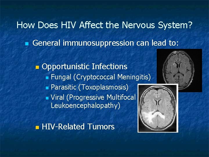 How Does HIV Affect the Nervous System? n General immunosuppression can lead to: n How Does HIV Affect the Nervous System? n General immunosuppression can lead to: n