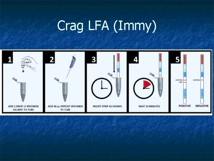 Crag LFA (Immy) Crag LFA (Immy)